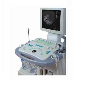 Macchina del sistema diagnostico ultrasonico visibile ginecologico approvata CE/ISO (MT01006081)