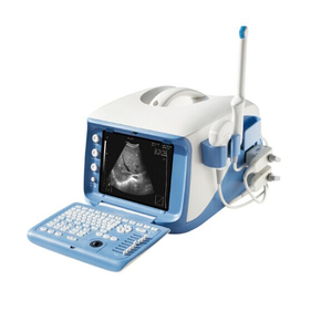 Macchina ultrasonica portatile del sistema diagnostico dell'ospedale 4D (MT01006101)